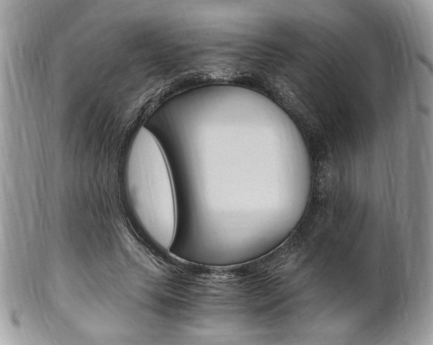 X0000101410639200807071007