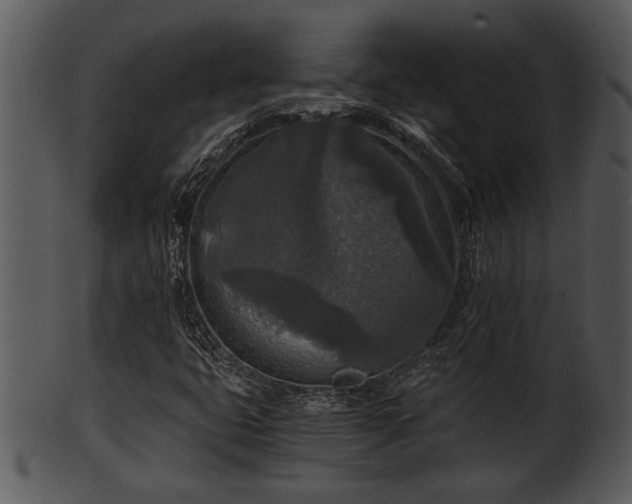 X0000101411399200807141120
