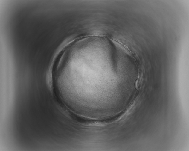 X0000101410198200807211103