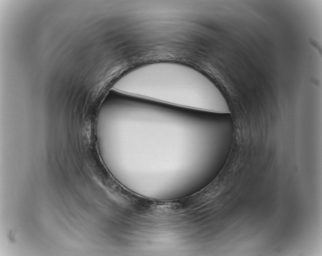 X0000101420072200807071041