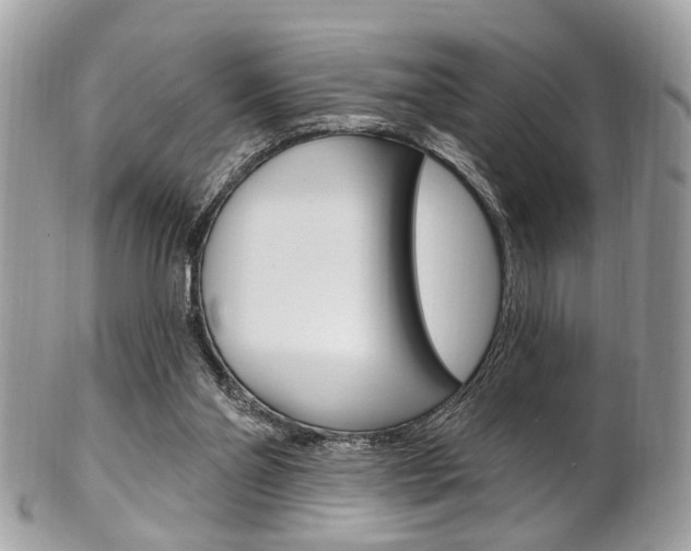 X0000101420110200807071040