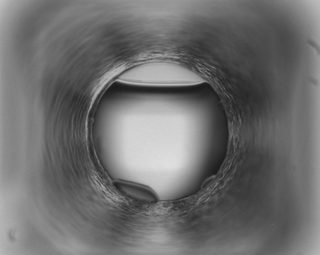X0000101420148200807071039