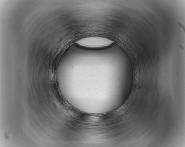 X0000101420176200807071040