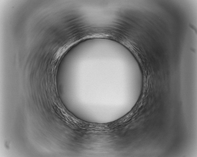X0000101420337200807071036