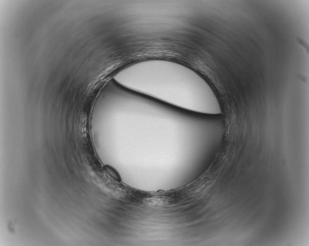 X0000101420356200807071036