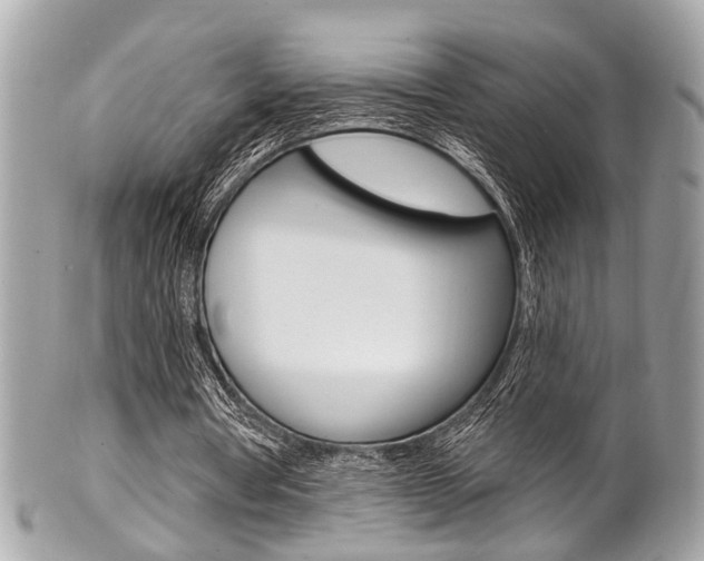 X0000101420386200807071036