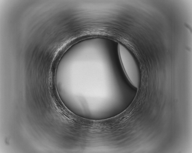 X0000101420388200807071036