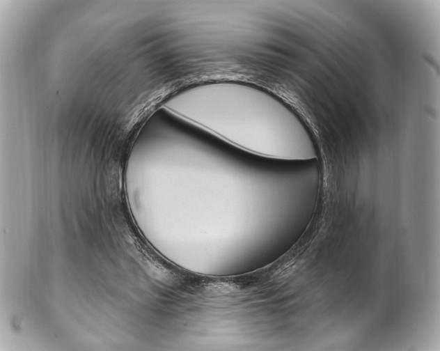 X0000101420397200807071036