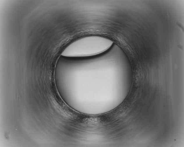 X0000101420639200807071032