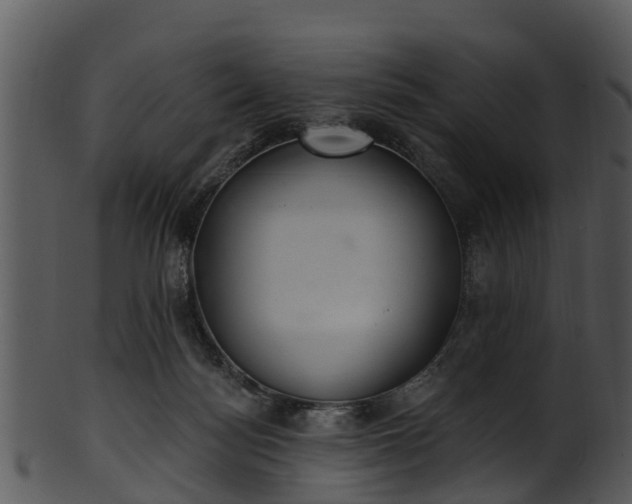 X0000101420172200807141202