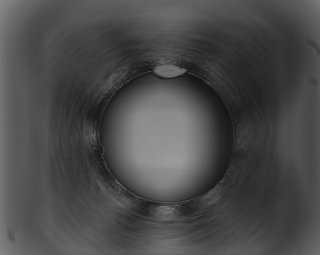 X0000101420176200807141202