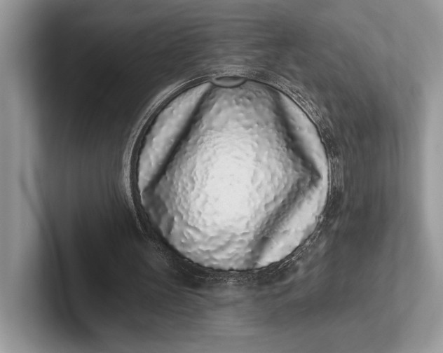X0000101420147200807211136
