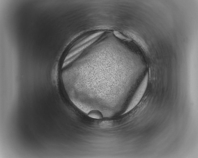 X0000101420156200807211136