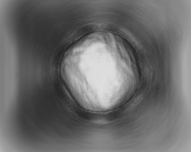 X0000101420169200807211136