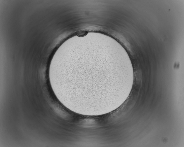 X0000101420159200808041136