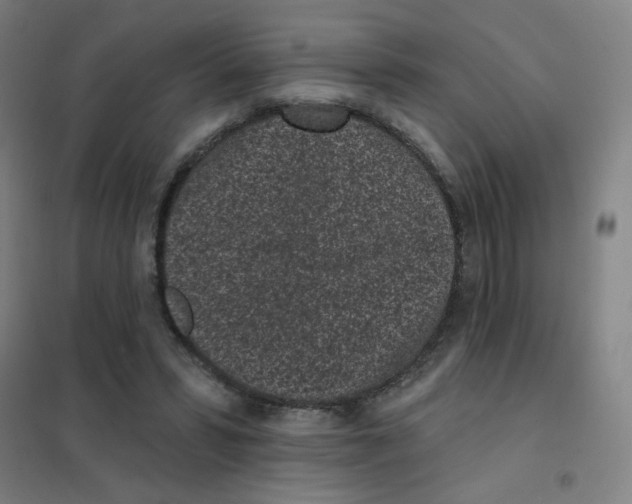 X0000101420399200808041132