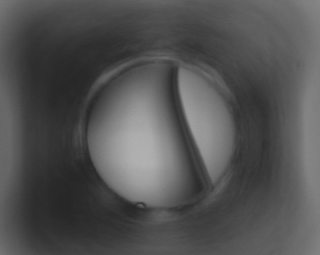 X0000101431176200807070959