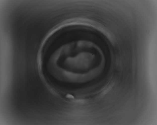 X0000101431522200807071331