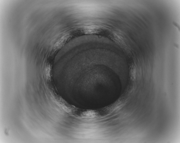 X0000101430219200807281008