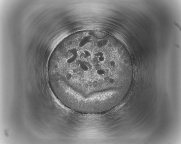 X0000101431087200807280955