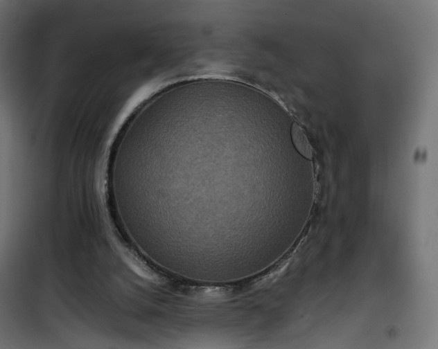 X0000101440056200807141316