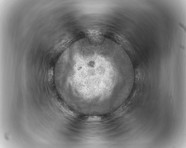 X0000101440369200807281028