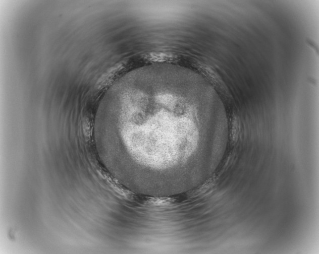 X0000101440569200807281025