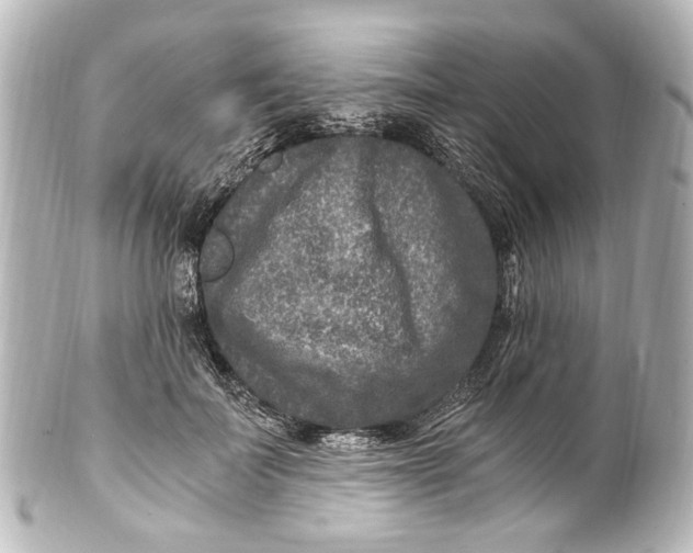 X0000101440699200807281023