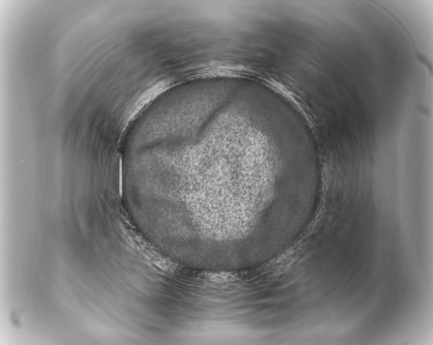 X0000101441219200807281015