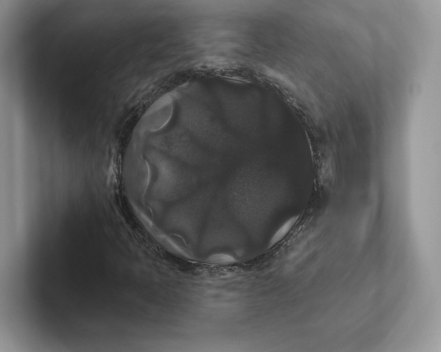 X0000101451397200807211303