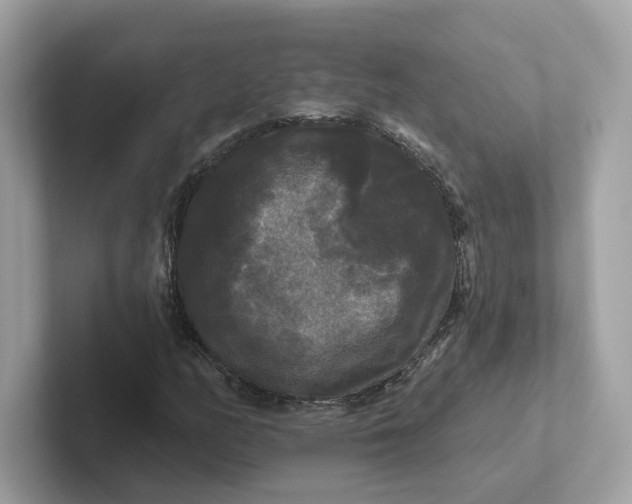 X0000101451158200807280933