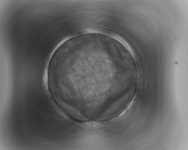 X0000101451198200807280933