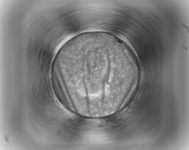 X0000101451197200808041011