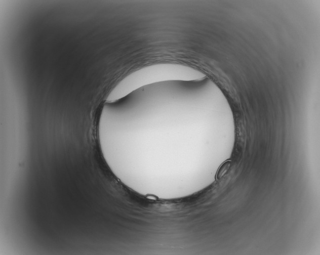 X0000101460419200807281003