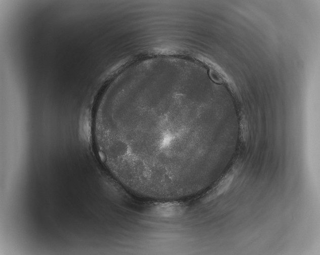 X0000101460446200807281003