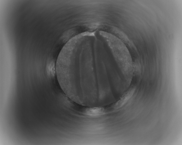 X0000101460479200807281003