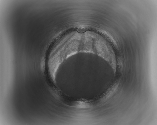 X0000101460496200807281002