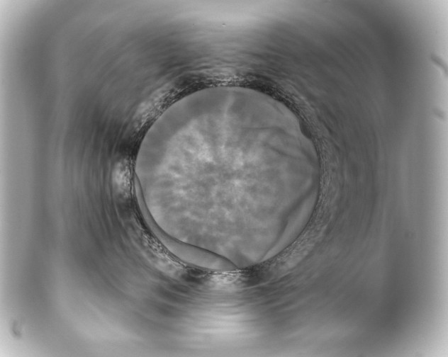 X0000101460720200808041042