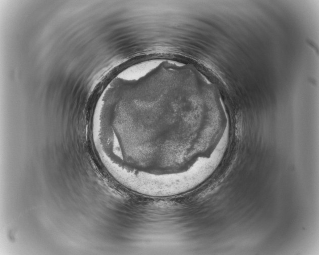 X0000101461117200808041035