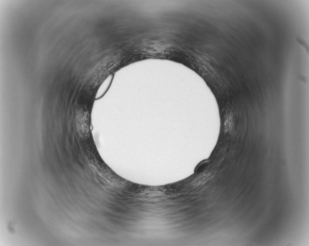 X0000101461156200808041035