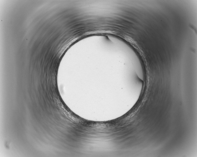 X0000101461177200808041035