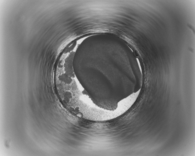X0000101461179200808041035