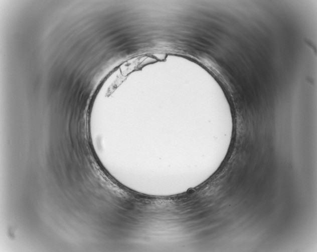 X0000101461238200808041034
