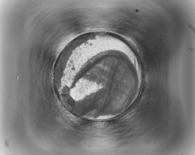 X0000101461279200808041033