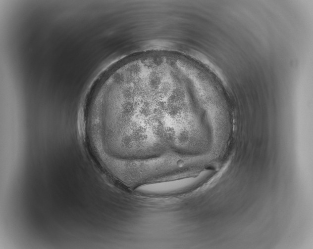 X0000101471117200807281014