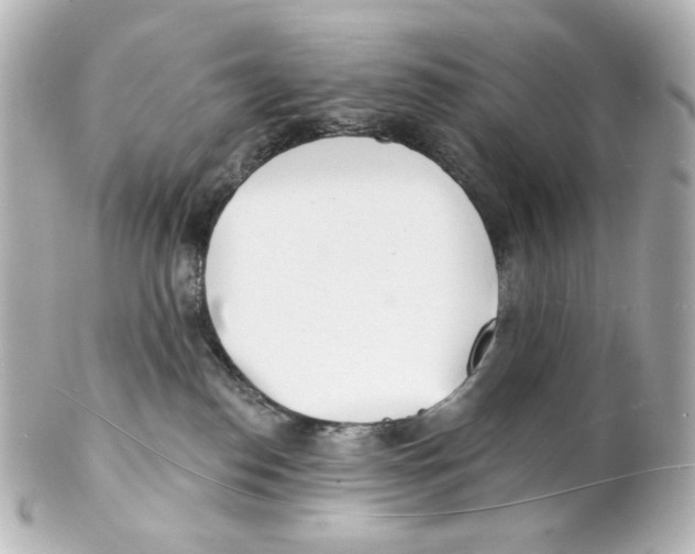 X0000101470186200808041114