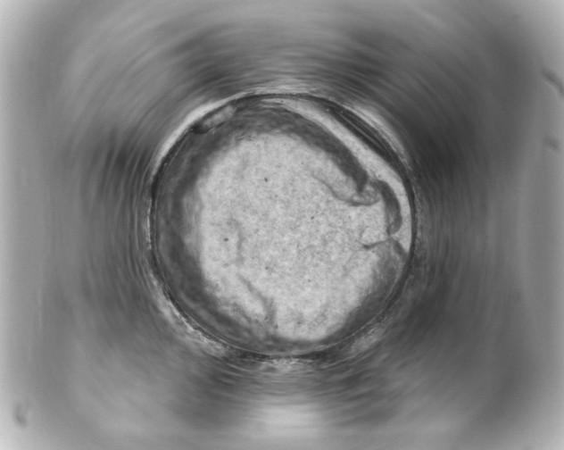 X0000101471000200808041101