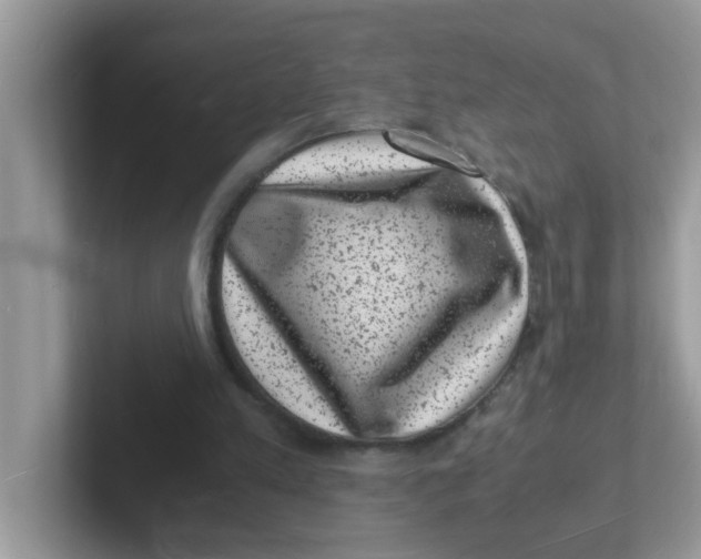 X0000101480197200807281046