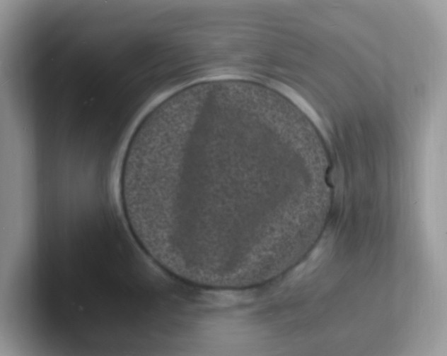 X0000101481197200807281033