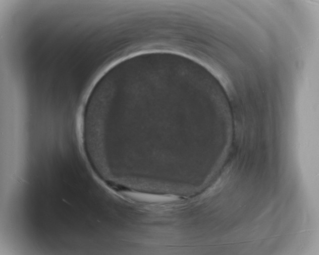 X0000101481527200807281029